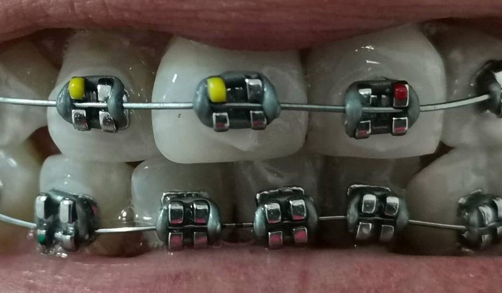 Beyoutiful - Clínica dental - Dental clinic